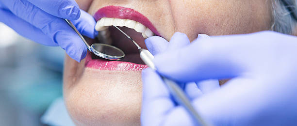 Best Walk-In Emergency Dentist in Union City, OK